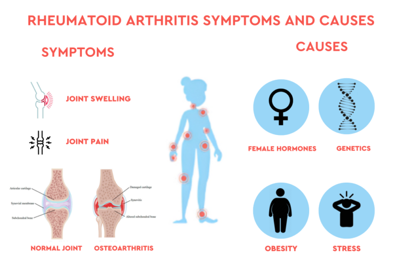 How Women Can Prevent and Manage Risk for Osteoarthritis