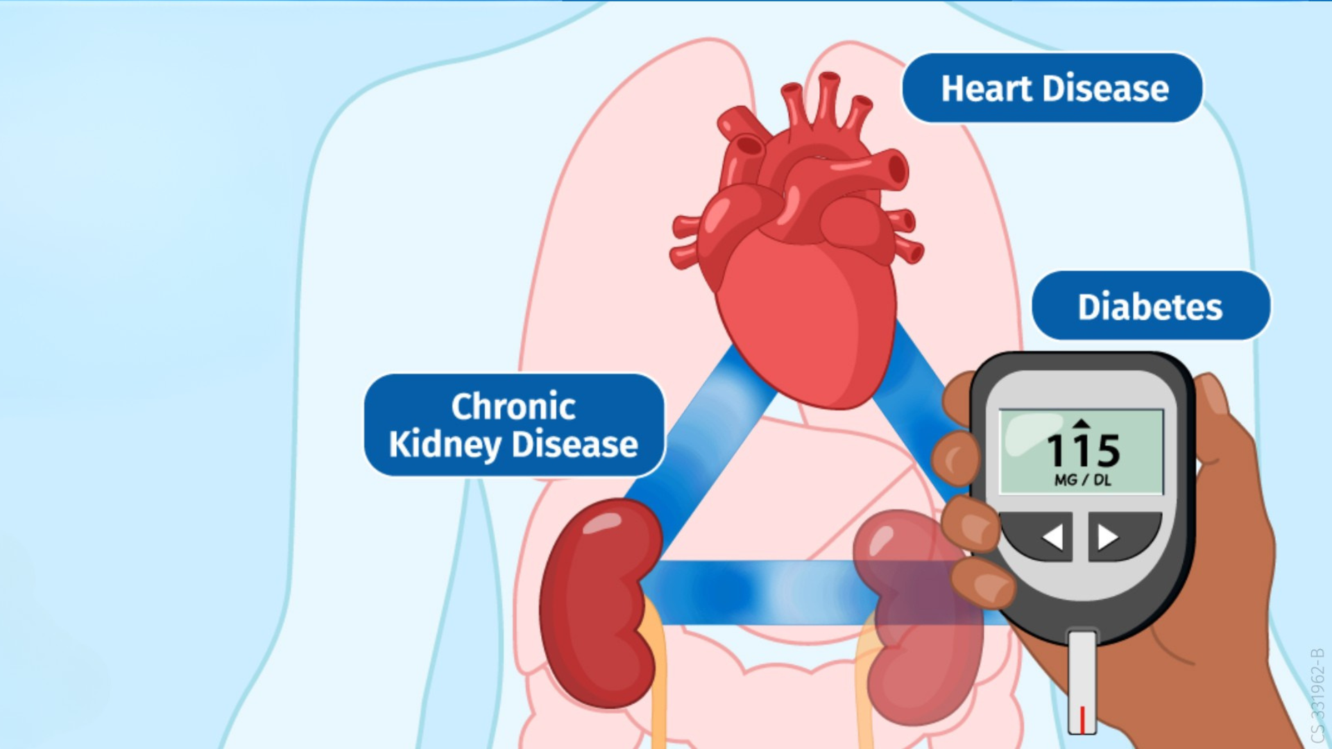 Intertwined Tracks: Obesity, Diabetes, and Organ Damage. 